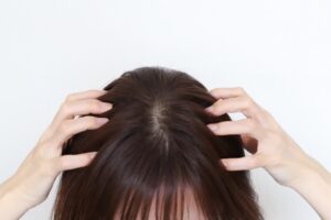 頭皮の悩み/抜け毛/匂い