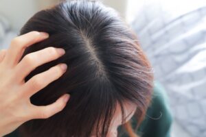 ベタつく髪