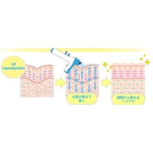 エステ　ターンオーバー